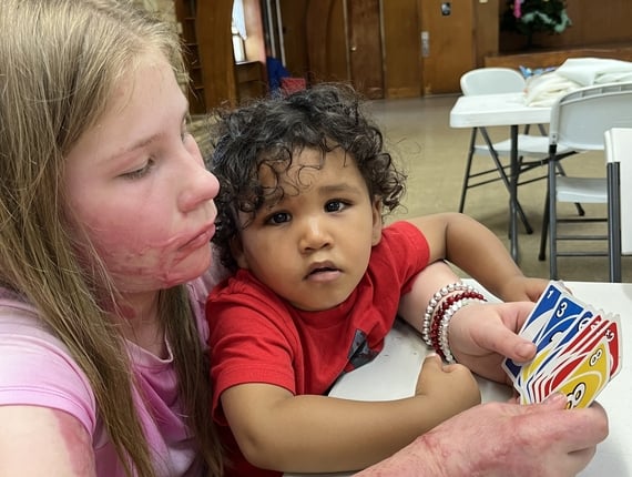 Children who suffered burns playing Uno at ACBC's summer camp